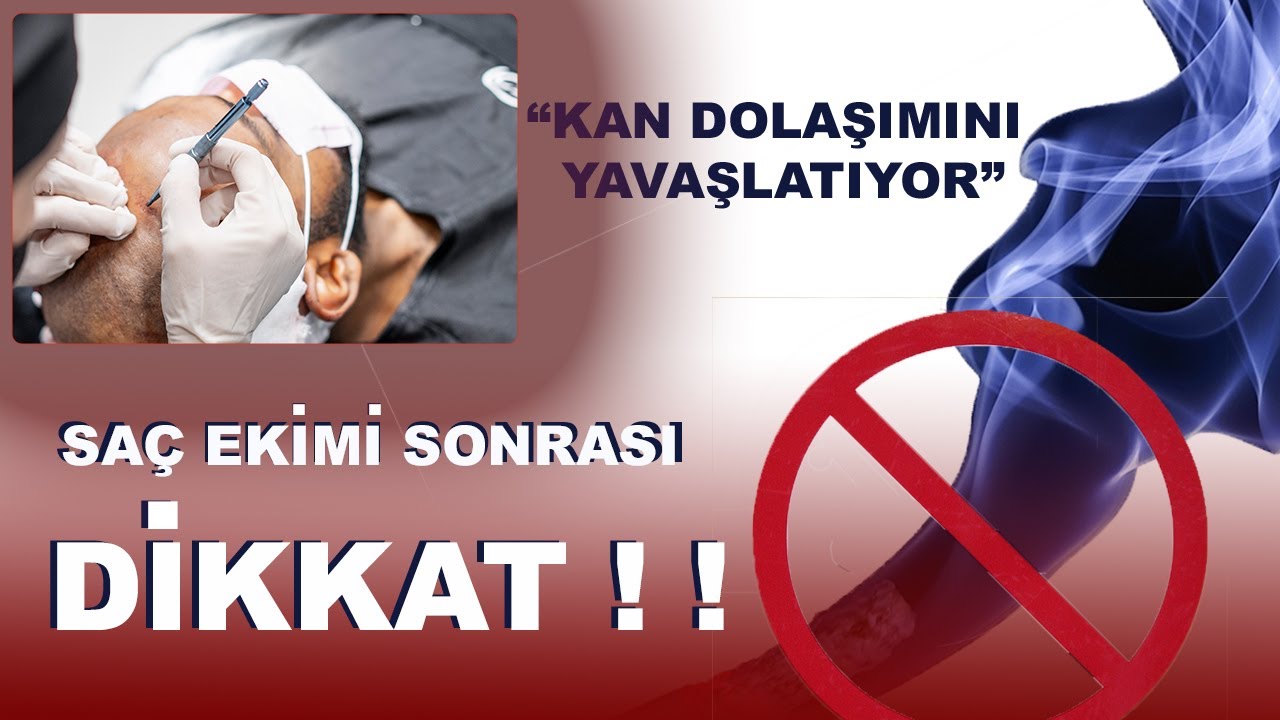 Saç Ekimi Sonrası Dikkat Edilmesi Gereken 5 Kural! I FATMA DURSUN