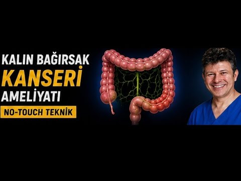 Kalın Bağırsak Kanseri Ameliyatı, Hastanın Daha Uzun Yaşaması İçin Ayrıntılar | Prof. Dr. Ünal Aydın